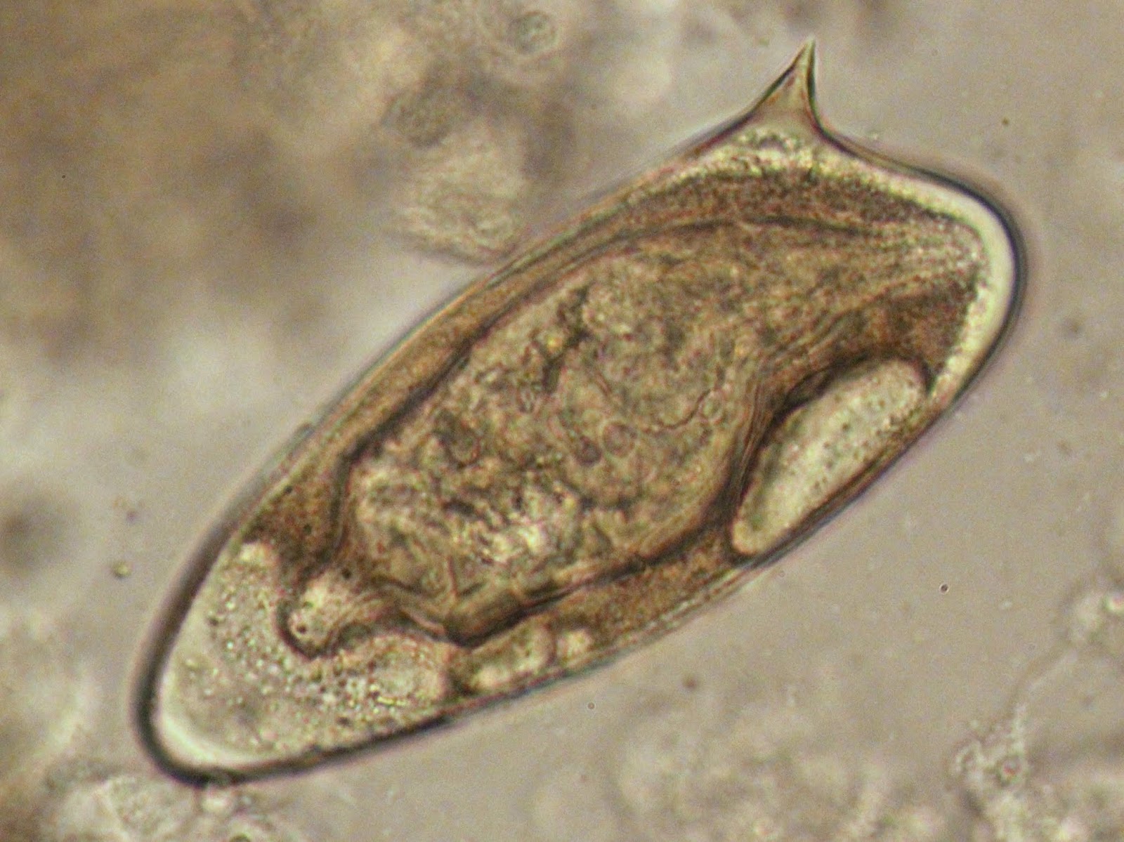 Schistosoma mansoni яйца